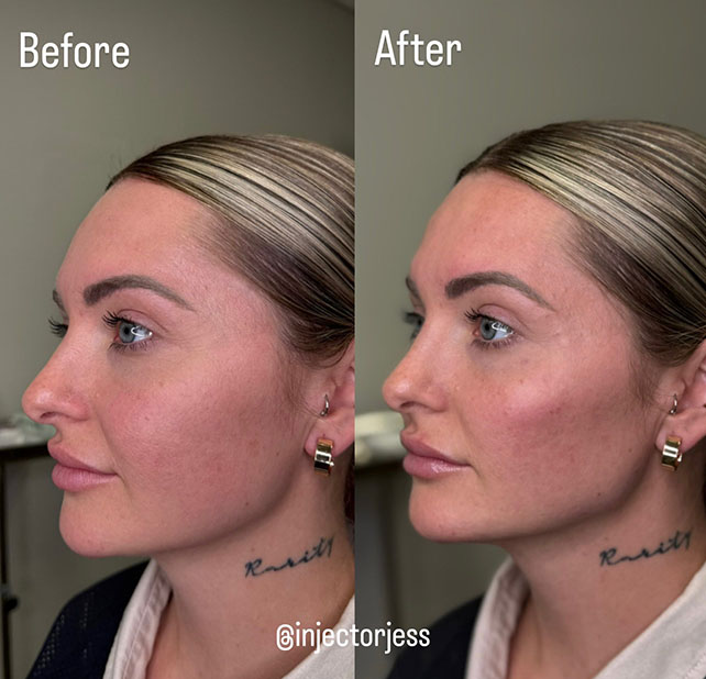 Updated Jawline 3