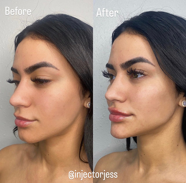 Updated jawline 4