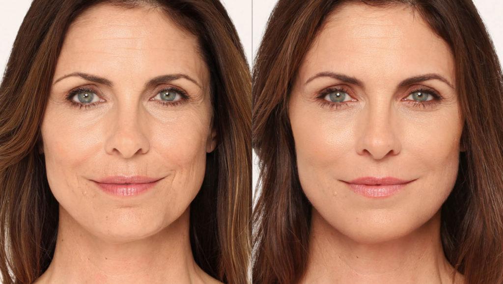 what-to-expect-before-during-and-after-treatment