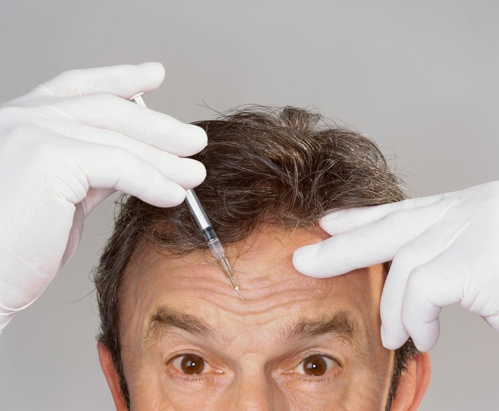 Botox: The Original Wrinkle Relaxer