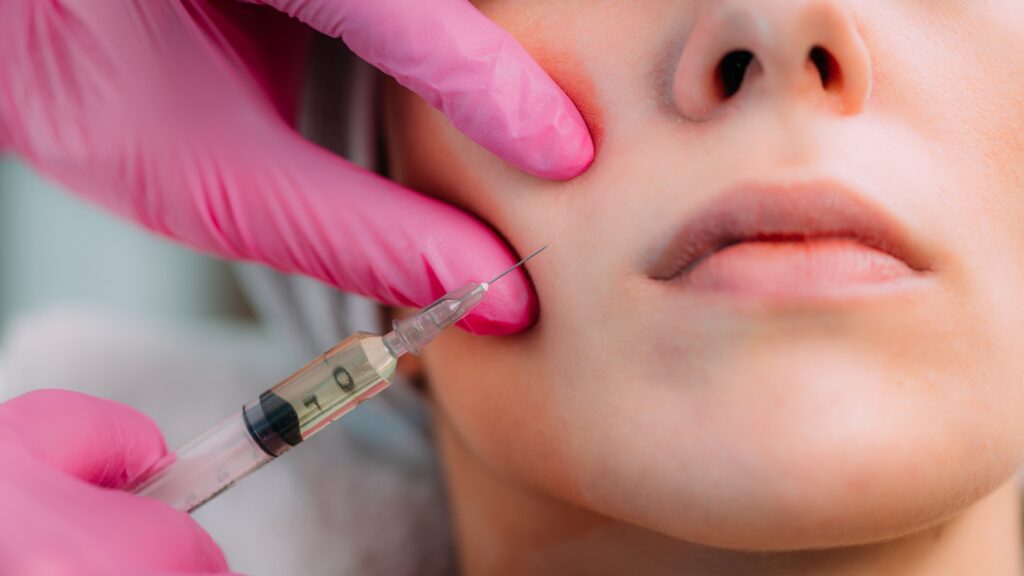 What to Expect During Sculptra Treatment at Lux Injectables