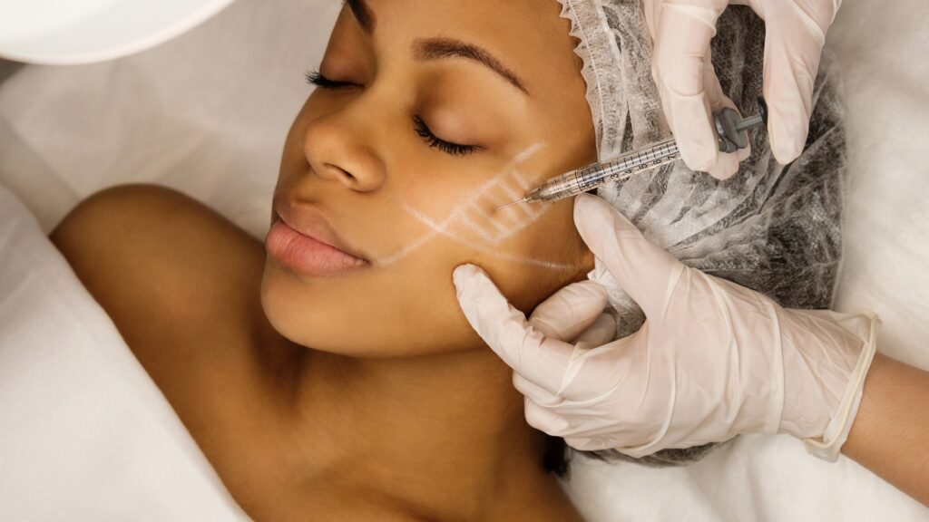 How Sculptra Works to Rebuild Collagen Naturally