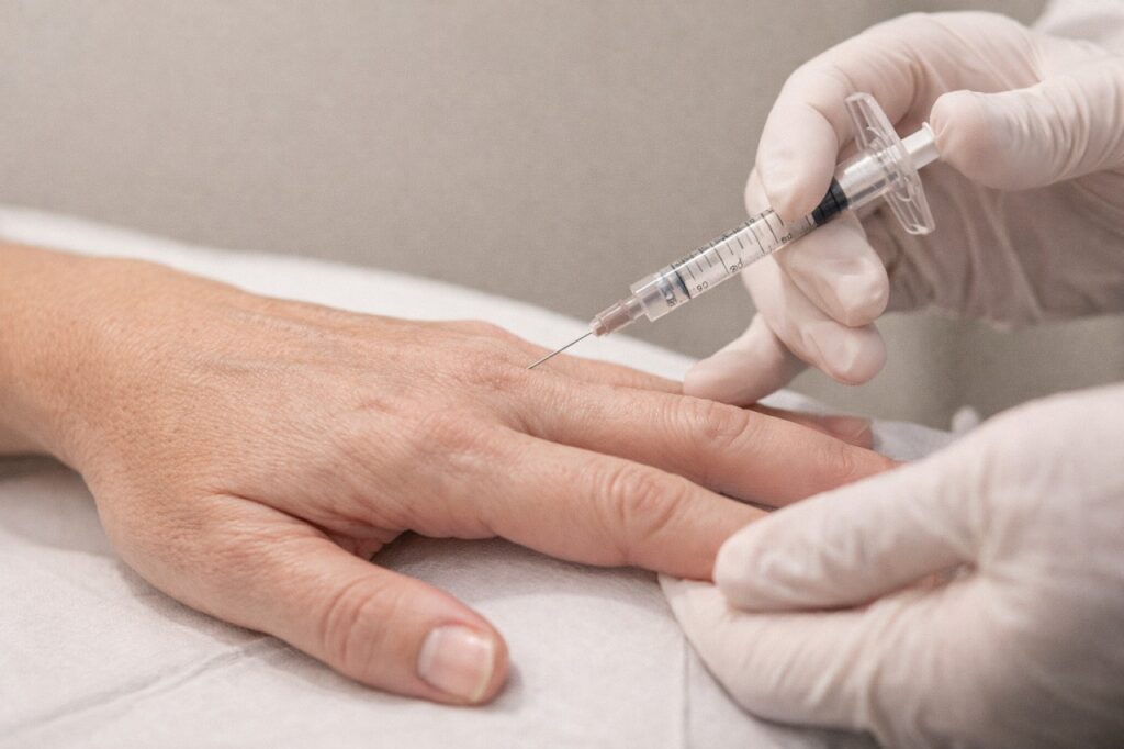 The Hand Filler Injection Process at Lux Injectables