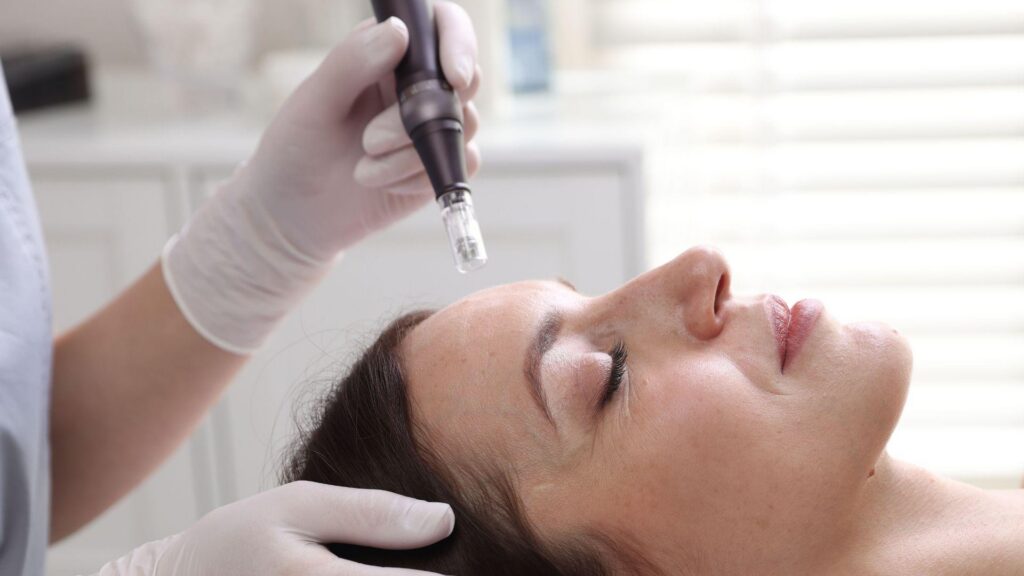 What to Expect During a Microneedling Appointment